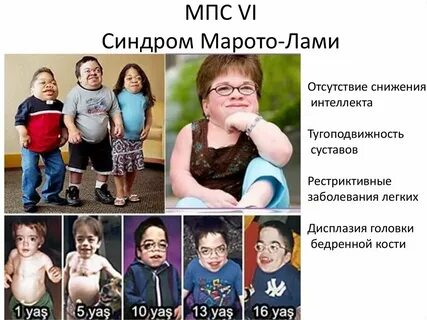 Тип ви