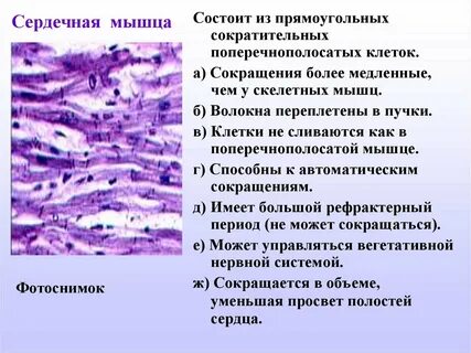 Сердечная ткань какая