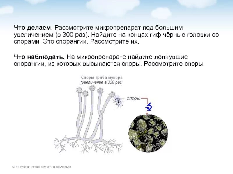 Обнаружены споры и мицелий. Микро припарат груба мукор. Рассмотрите микропрепарат плесени гриба мукора. Строение плесневого гриба мукора. Строение спорангия мукора.