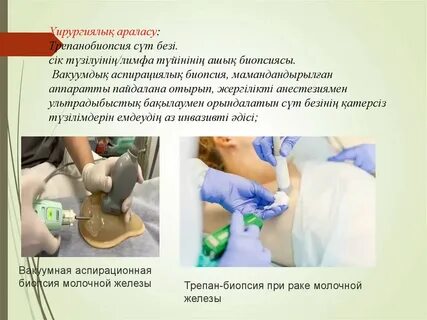 Егер жыныстық қатынас кезінде презерватив кенеттен шығып кетсе