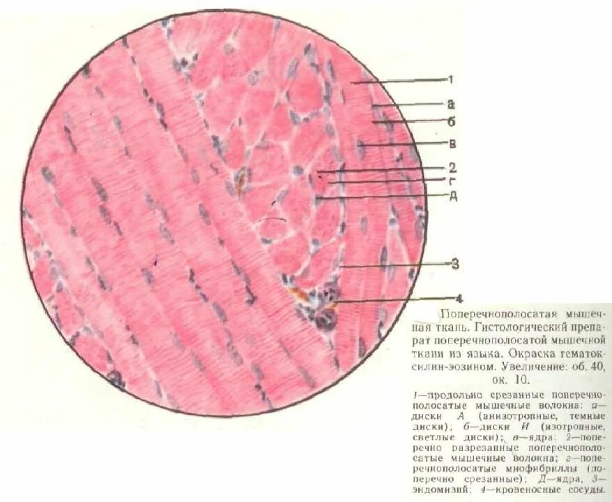 Поперечно Скелетная мышечная ткань. Поперечнополосатая мышца гистология. Поперечно полосатая Скелетная ткань гистология. Поперечно полосатая Скелетная ткань препарат. Препарат поперечно полосатая мышечная ткань