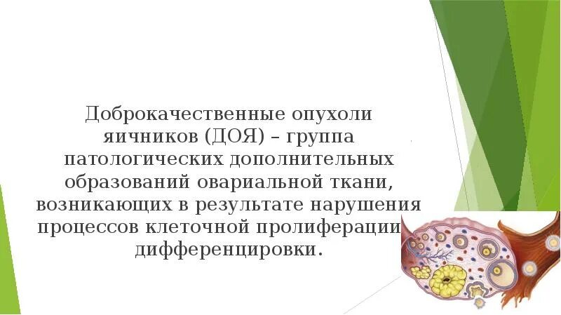 Доброкачественные новообразования яичников. Доброкачественное новообразование яичника. Доброкачественная опухоль яичника. Опухоли яичников презентация. Развитие рака яичников