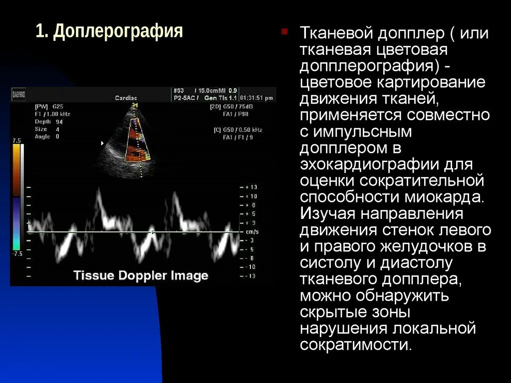 Эхокг сдла