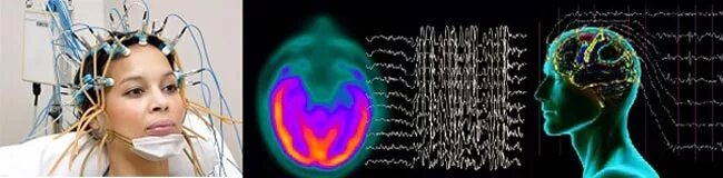 Электроэнцефалограмма. Электрическая активность мозга. Биоэлектрическая активность головного мозга. Прибор электрическая активность головного мозга. Характер изменений биоэлектрической активности мозга
