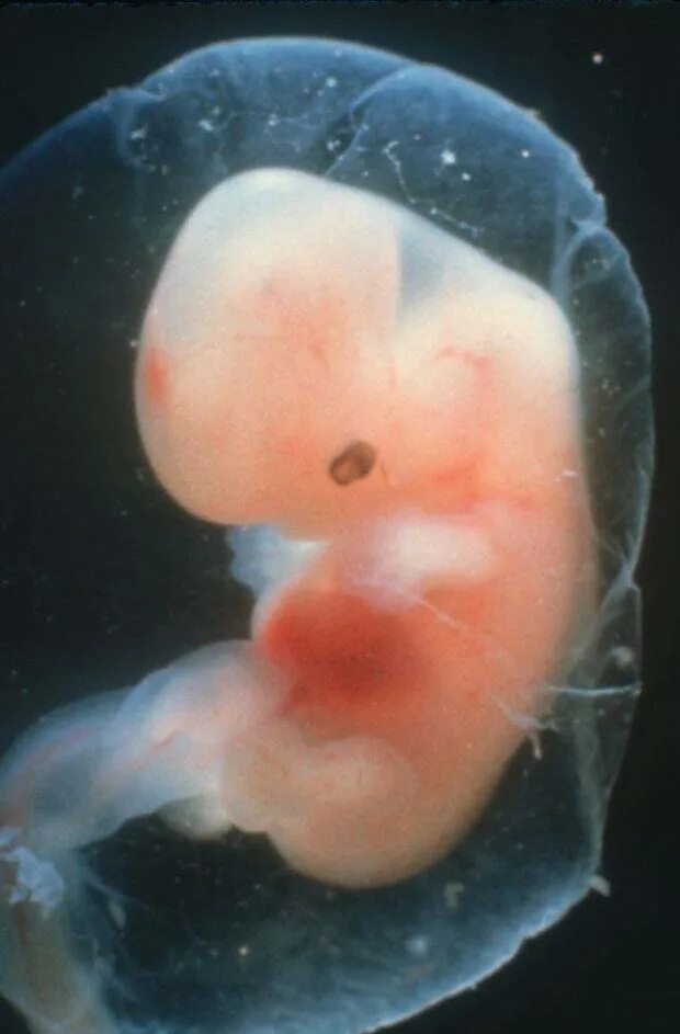 Эмбрион на 6 неделе беременности. Эмбрион 5-6 недели беременности. 5 6 Недель беременности фото эмбриона. Эмбрион 5,5 5 неделя берем. Что будет через 5 недель