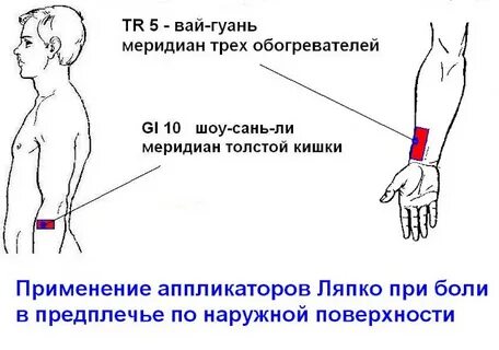 Болит левое предплечье