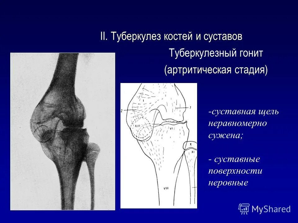 3 признака сустава