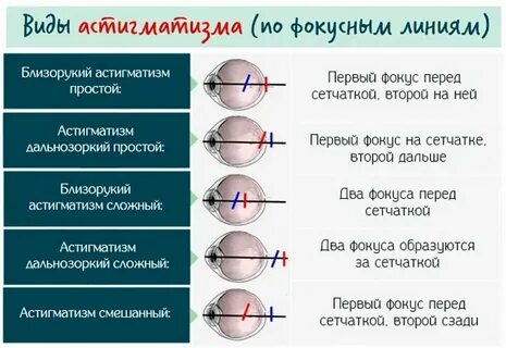 Транспозиция калькулятор астигматических