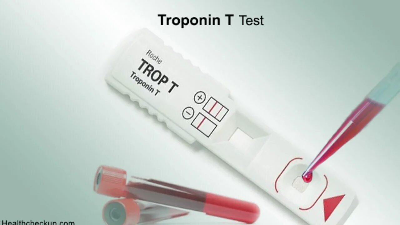 Tests t ru. Тропонин/тропониновый тест. Экспресс тест на тропонин. Экспресс метод тропонина. Тест на инфаркт миокарда тропонин.