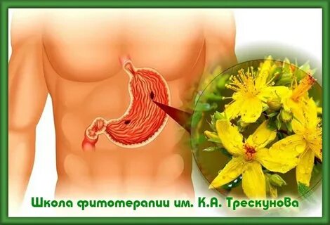 Какие травы лечат язву