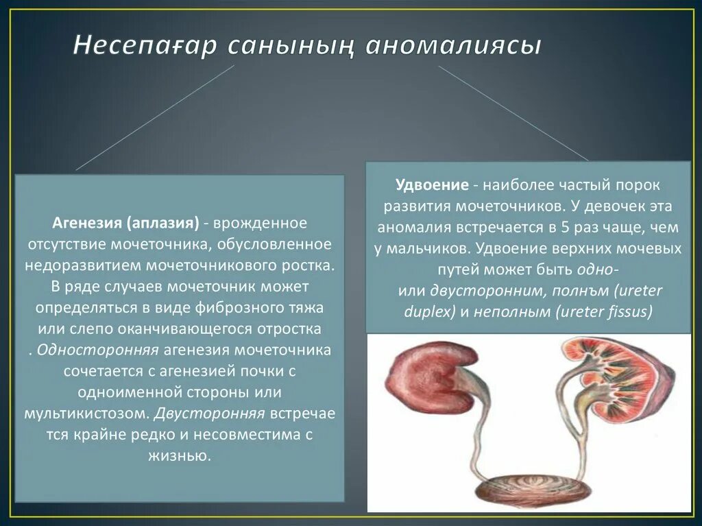 Врожденные аномалии мочеточников. Аномалии развития почек. Пороки мочевыделительной системы. Пороки развития мочеточника.