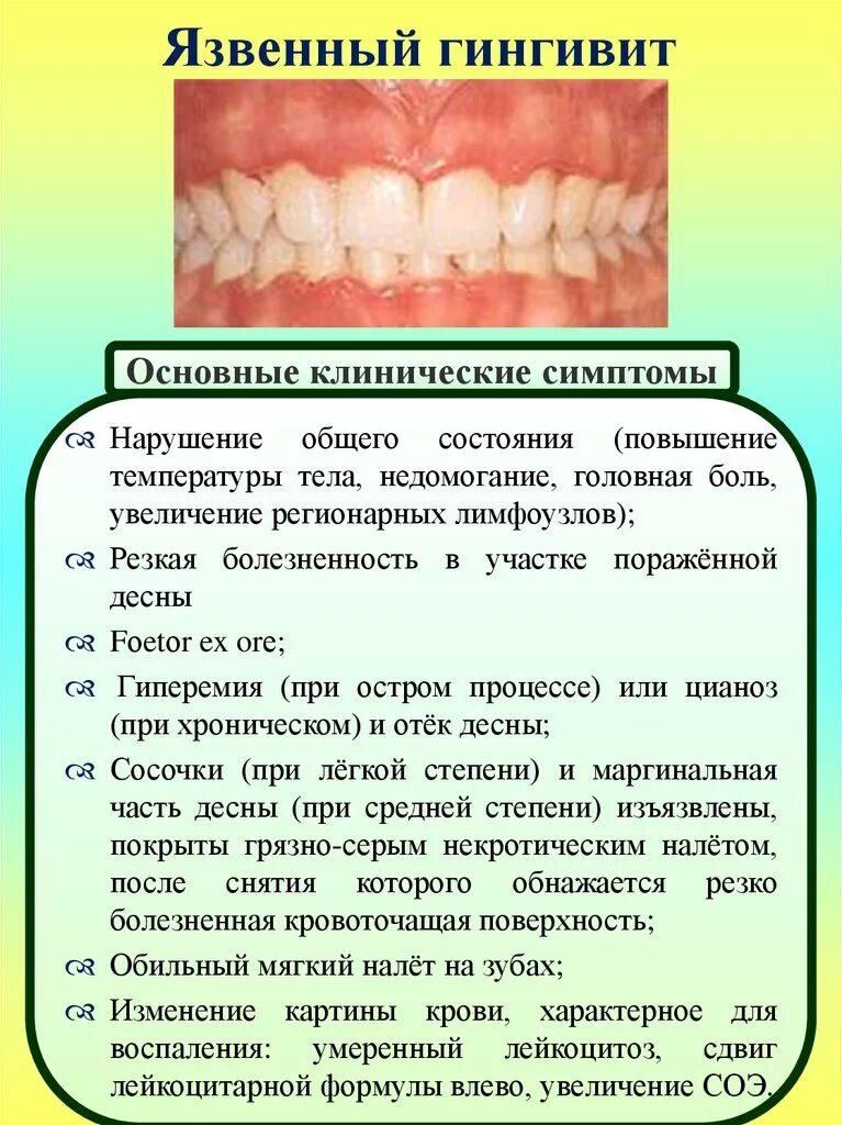 Чем грозит воспаление. Гидантоиновый гингивит это. Некротически язвенный гингивит. Некротически язвенный гингив т. Острый язвенно-некротический гингивит Венсана.