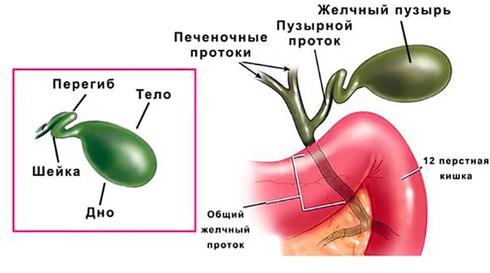 Ограничения желчного пузыря. Желчный пузырь с перегибами в области шейки и тела. Перегиб в шейке желчного пузыря. Желчный пузырь загиб в области тела. Перекрут желчного пузыря.