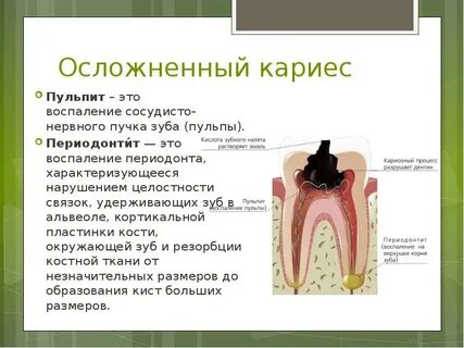 Болезни пульпы