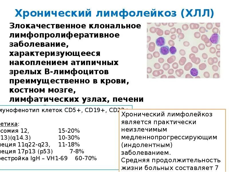 Для хронического лимфолейкоза характерно. В -лимфоциты хронический лимфолейкоз. Хронический лимфоцитарный лейкоз анализ крови. Хронический лимфолейкоз лейкоцитарная формула. Хронический лимфолейкоз тромбоциты.