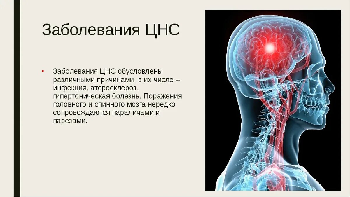 Поражение головного мозга болезнь. Заболевания нервной системы. Нарушение ЦНС. Поражение нервной системы. Болезни центральной нервной системы.