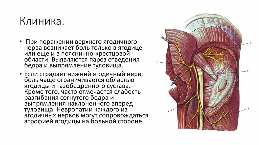 Невропатия наружная бедра. Верхний ягодичный нерв болит. Поражение верхнего ягодичного нерва. Верхний ягодичный нерв симптомы поражения. Нервы ягодичной области.