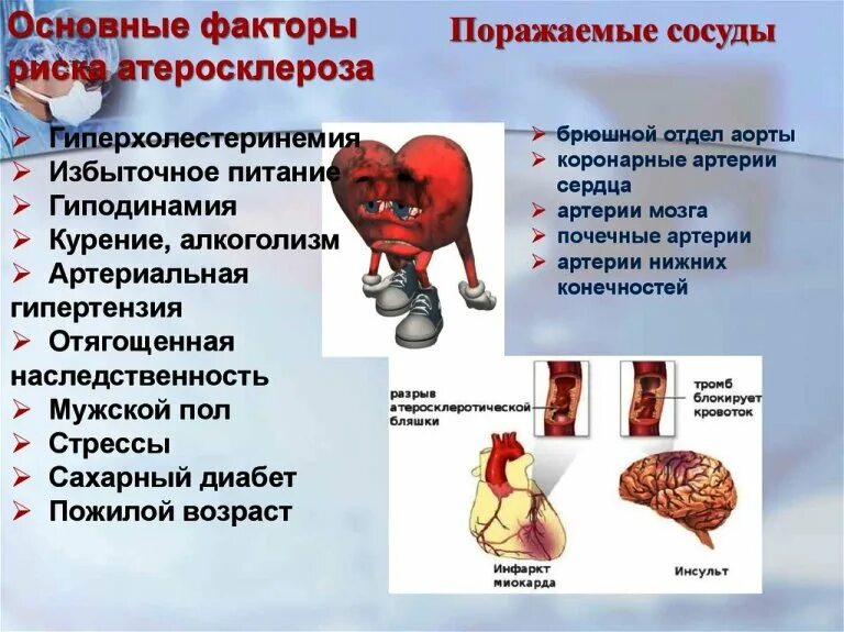 Факторы риска и профилактика атеросклероза. Профилактика атеросклероза сосудов нижних конечностей. причины и факторы атеросклероза. факторы риска атеросклероза. атеросклероз сосудов факторы риска.