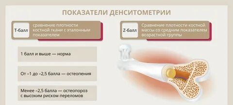 Анализ кости