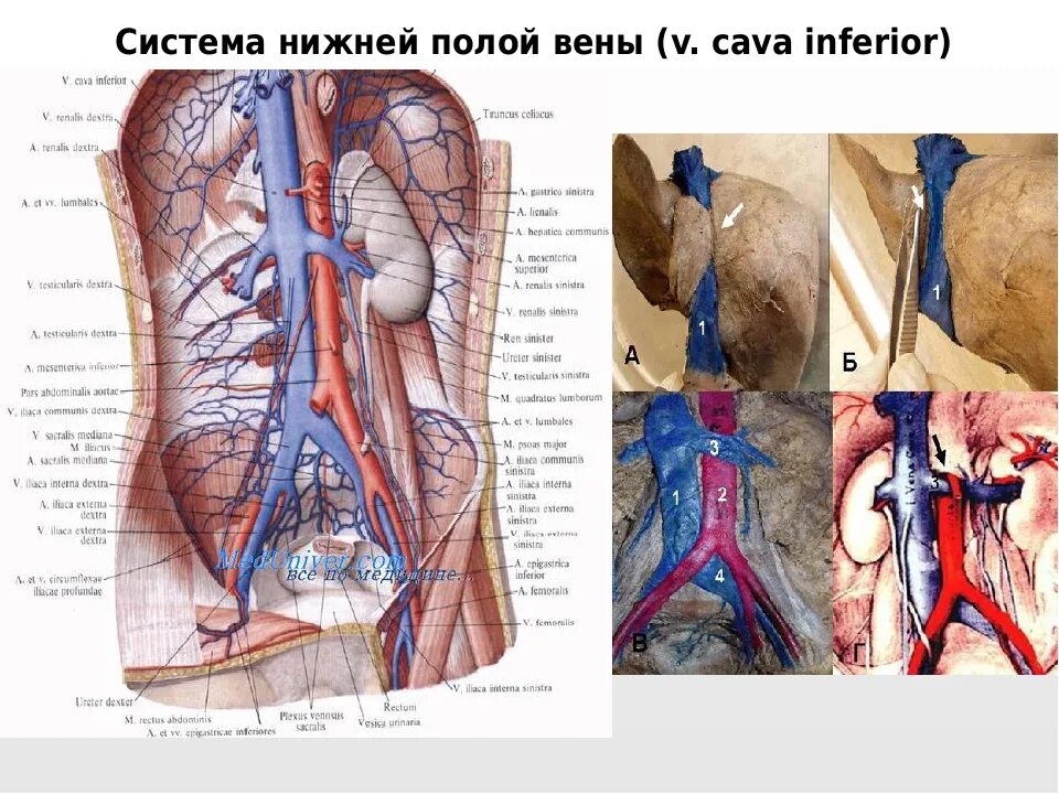 Нижняя полая Вена (v. Cava inferior). Полая анатомия нижняя Вена анатомия. Нижняя полая Вена Неттер. Нижняя полая Вена анатомия.