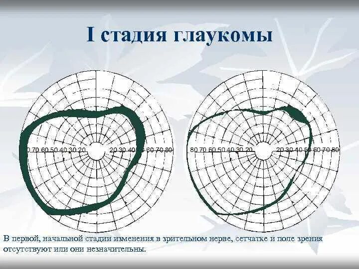 Периметрия норма схема. 1 поле зрения. Поле зрения глаза. Периметрия при вторичной глаукоме. Центральные скотомы в поле зрения.