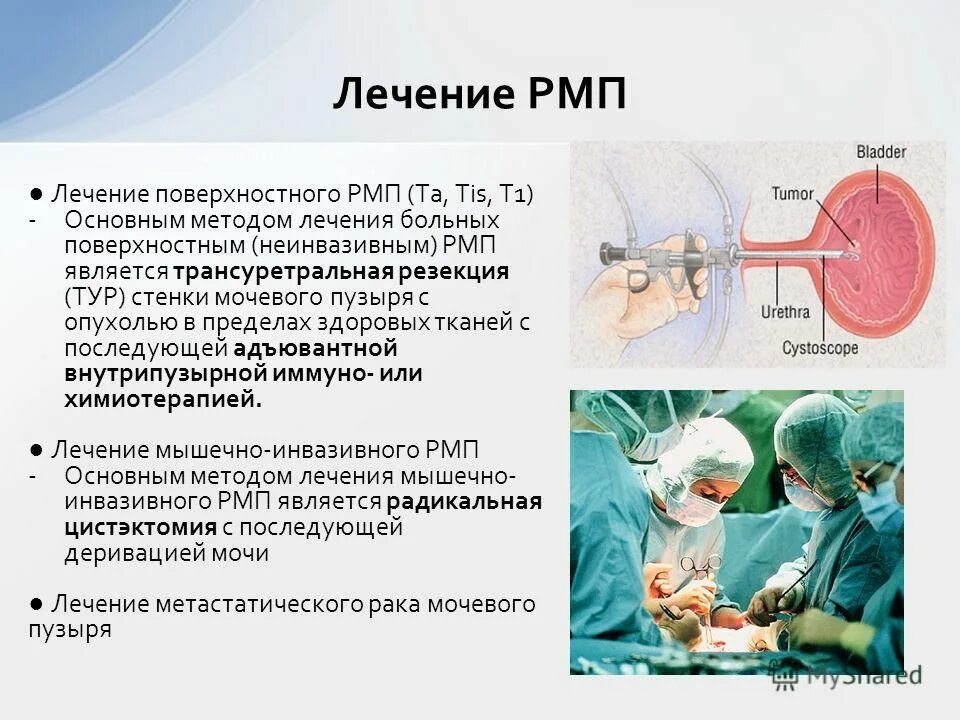 Реакция микропреципитации что это за анализ