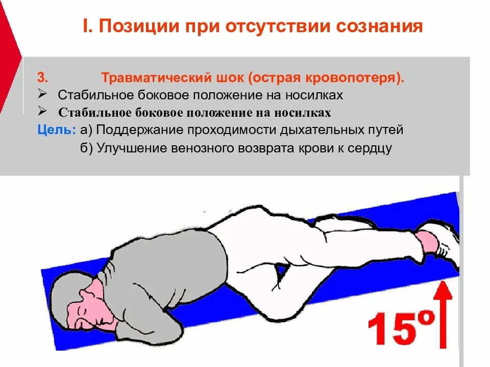 Придание оптимального положения