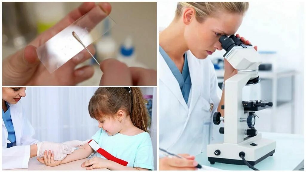 Elisa серология. биогельминтозы у детей. методы лабораторной диагностики гельминтов. основной лабораторный метод диагностики паразитарных болезней. анализы на паразиты в организме человека.