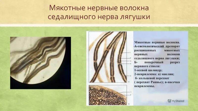 Строение нерва эпиневрий периневрий эндоневрий. Волокна нерва. Волокна нерва. Нервные волокна по функции. Эпиневрий периневрий эндоневрий нервные волокна.