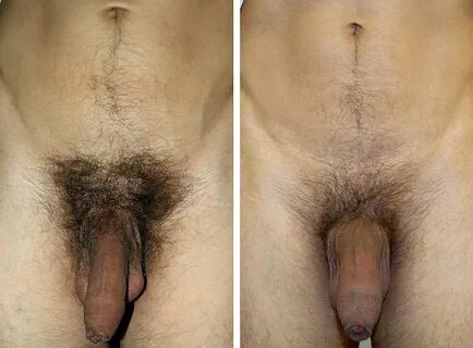 File:male pubic hair style.jpg - wikimedia commons