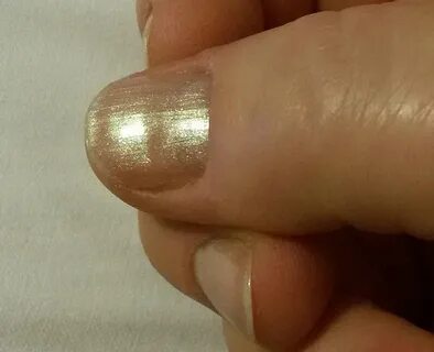 Проблема горизонтальных вмятин на ногтях: причины, симптомы и лечение. Красивые 