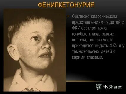 Классическая фенилкетонурия по утвержденным