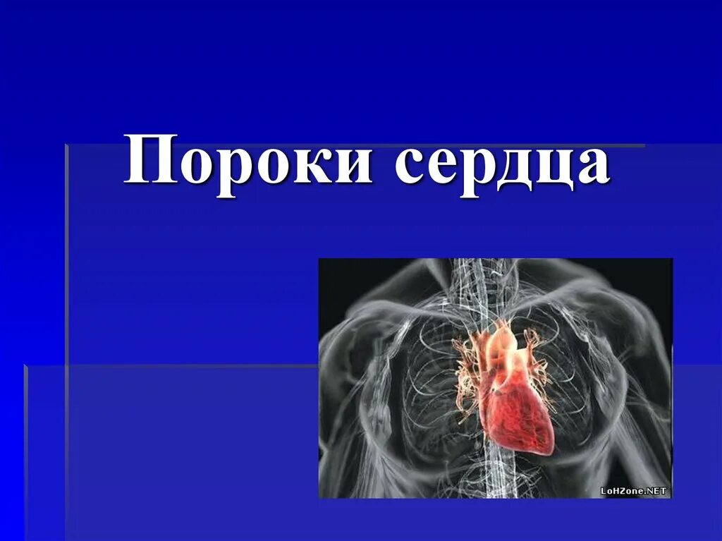 Пороки сердца презентация. Приобретенные пороки сердца презентация.