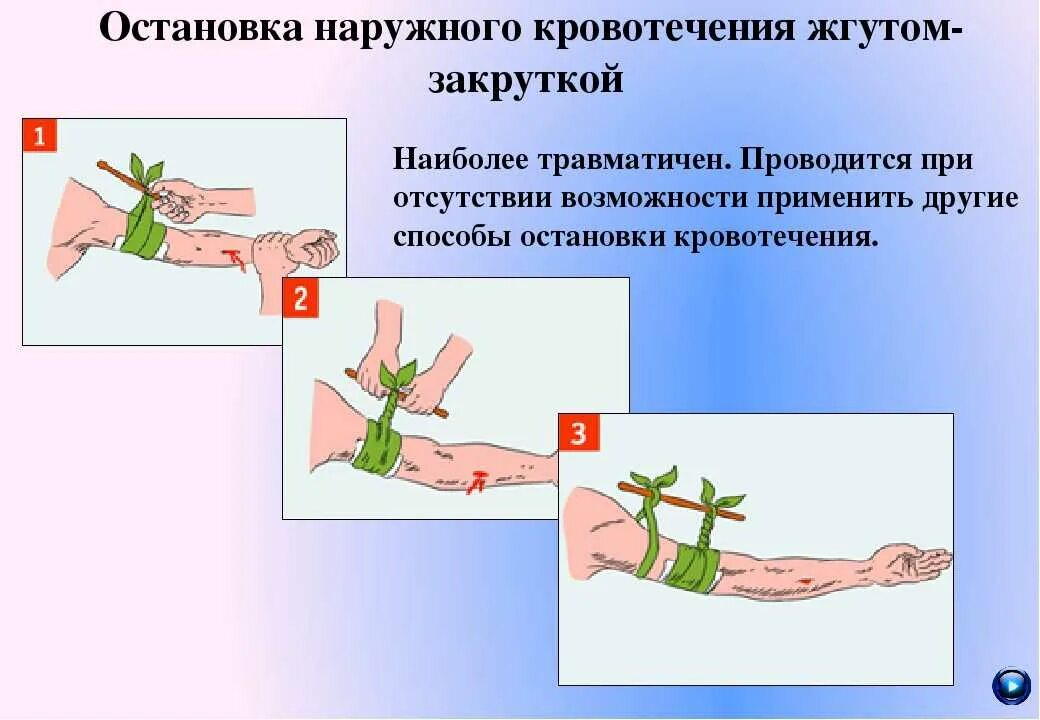 Алгоритм наложения жгута закрутки при кровотечении. Остановка кровотечения наружное артериальное. Остановкакровотеечния. Остановка кровотечени. Повреждение мелких артерий кистей и стоп