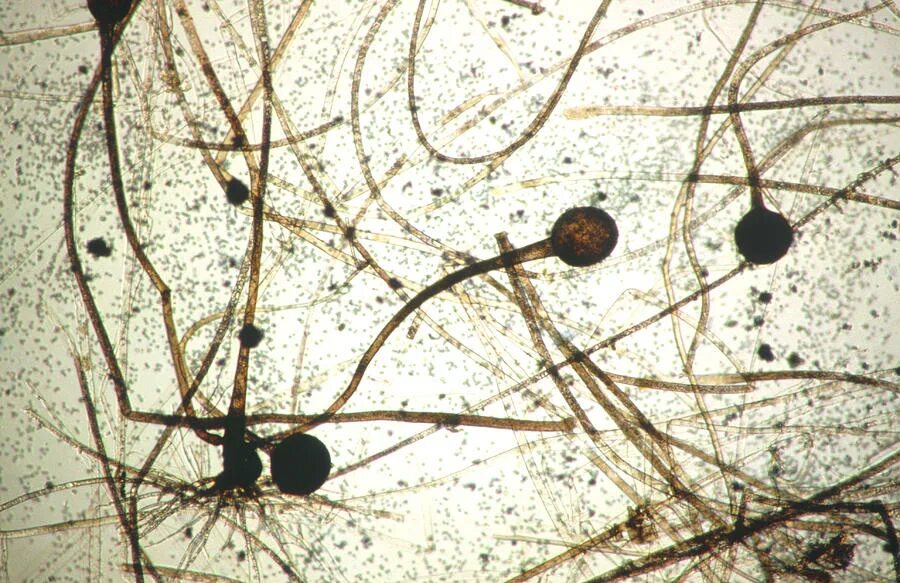 клетка мукора под микроскопом. клетка мукора под микроскопом. клетка плесени мукора под микроскопом. клетка плесневого гриба мукора. грибы рода mucor.