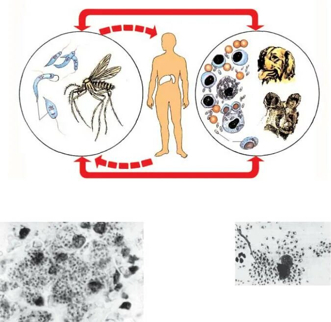 Возбудителем зоонозной малярии является. Лейшманиоз клинические проявления. Лейшманиоз пути заражения человека. Висцеральный лейшманиоз пути заражения человека. ПЕНДИНКА -кожный лейшманиоз.
