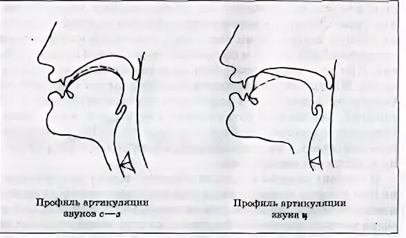 Звук правильно неправильно. Профили артикуляции свистящих звуков при ринолалии. Нарисуйте профили артикуляции свистящих звуков.. Профили артикуляции свистящих звуков. С З. Профиль свистящих звуков ц.