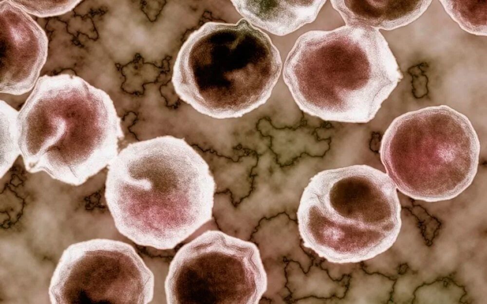 Chlamydia trachomatis mycoplasma genitalium. Урогенитальный хламидиоз. Урогенитальный хламидиоз бактерии. Хламидия трахоматис под микроскопом. Хламидиоз хламидии под микроскопом.