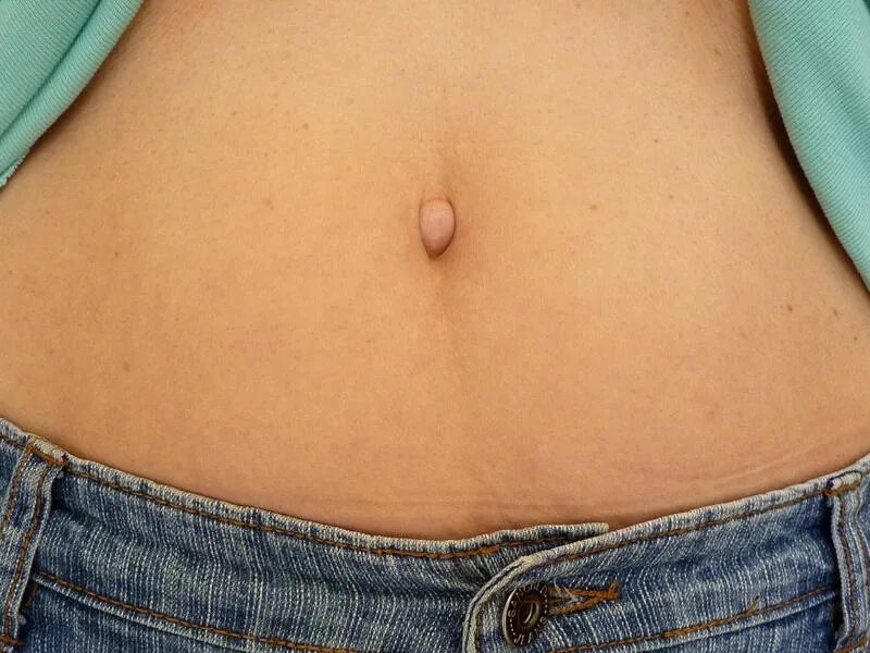 Почему пупок выпуклый. Женский глубокий пупок. Пупок девушки. Почему пупок выпуклый. Пупок выпуклый красивый.