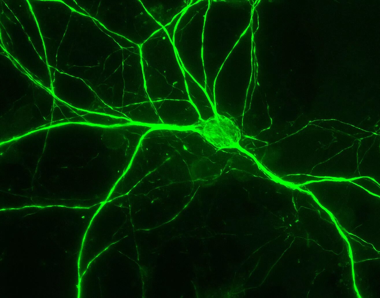 цвет нервных клеток. нервная клетка. цвет нервных клеток. пуринергические нейроны.