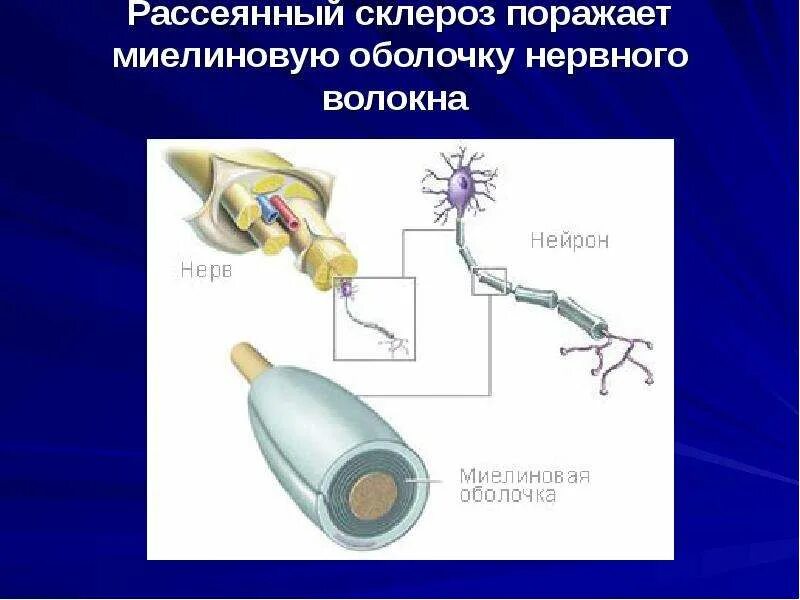 Миелиновая оболочка функции. Миелиновая оболочка нейрона. Рассеянный склероз миелиновая оболочка. Миелинизация нервных волокон. Рассеянный склероз поражает миелиновую оболочку.