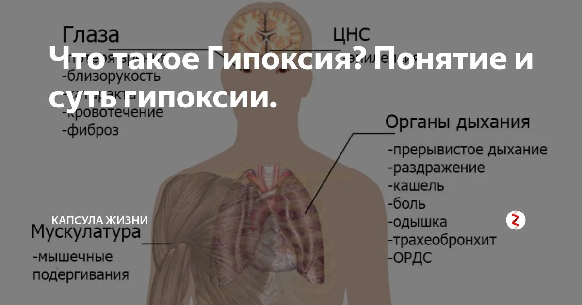 Кислородное голодание мозга у взрослых. Симптомы кислородного голодания головного мозга. Гипоксия головного мозга симптомы. Признаки гипоксии головного мозга.