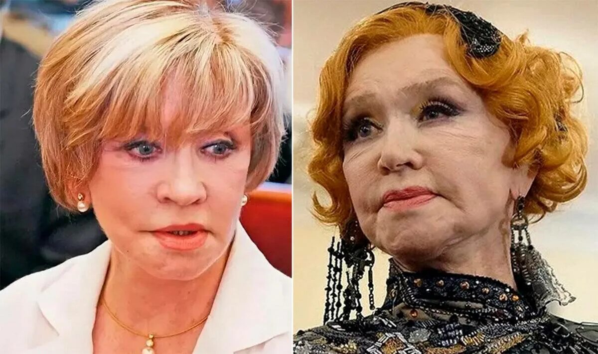 Дрозденко пластическая операция. Вера алентова сейчас 2025. меньшова вера неудачная пластика. вера алентова до и после пластики 2025. вера алентова пластическая операция.