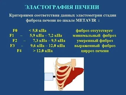 Фиброэластометрия печени кемерово