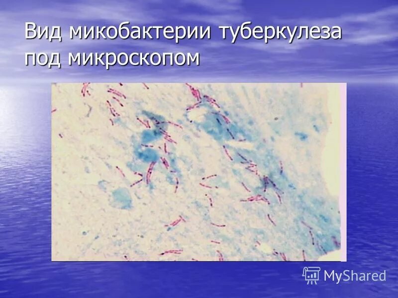 типы микобактерий туберкулеза