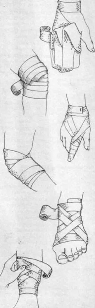 Десмургия повязки на конечности. Повязки на ногу десмургия. Колосовидная повязка на стопу. Наложение повязки на голень.