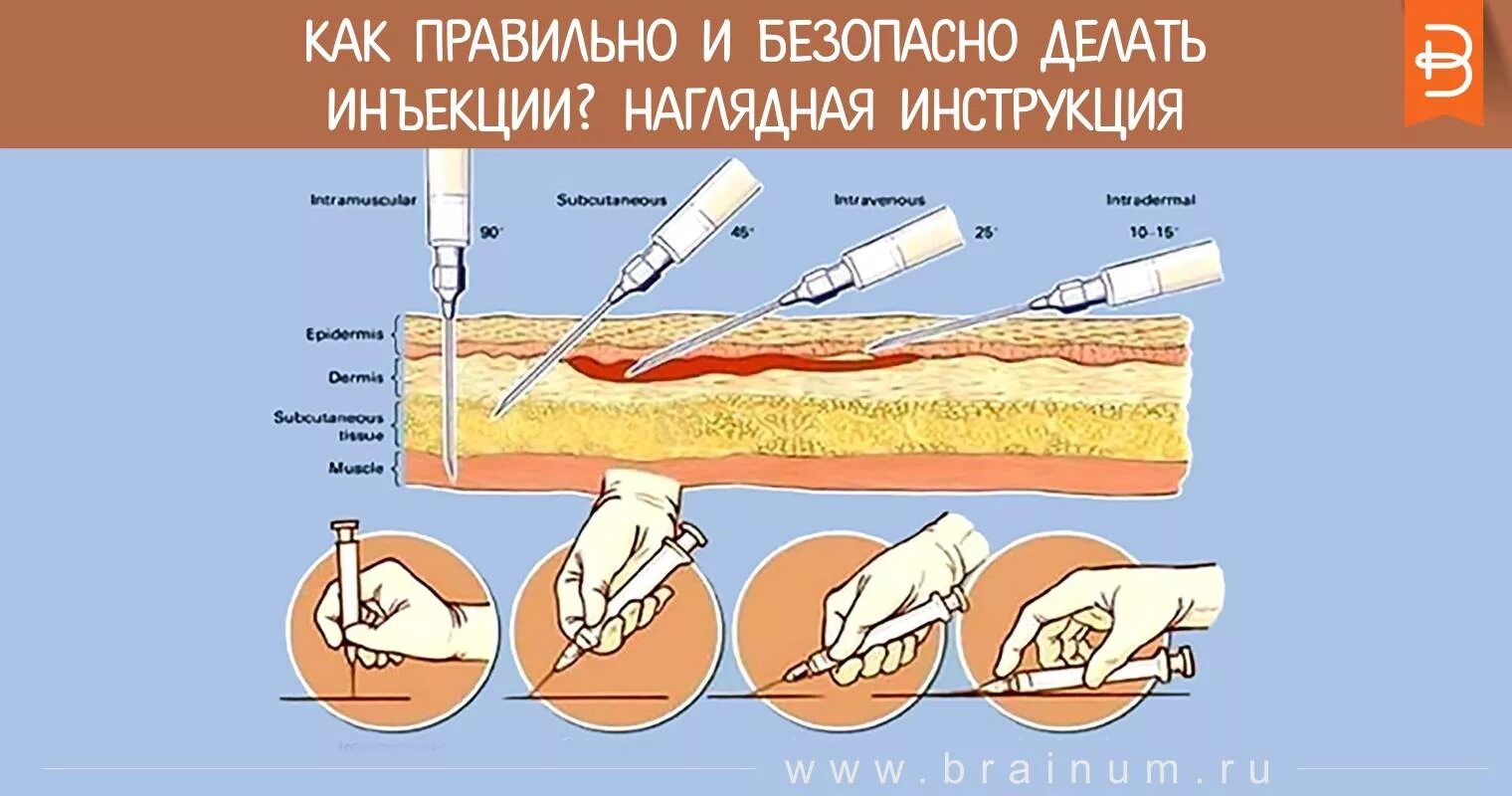 Внутримышечно куда можно колоть