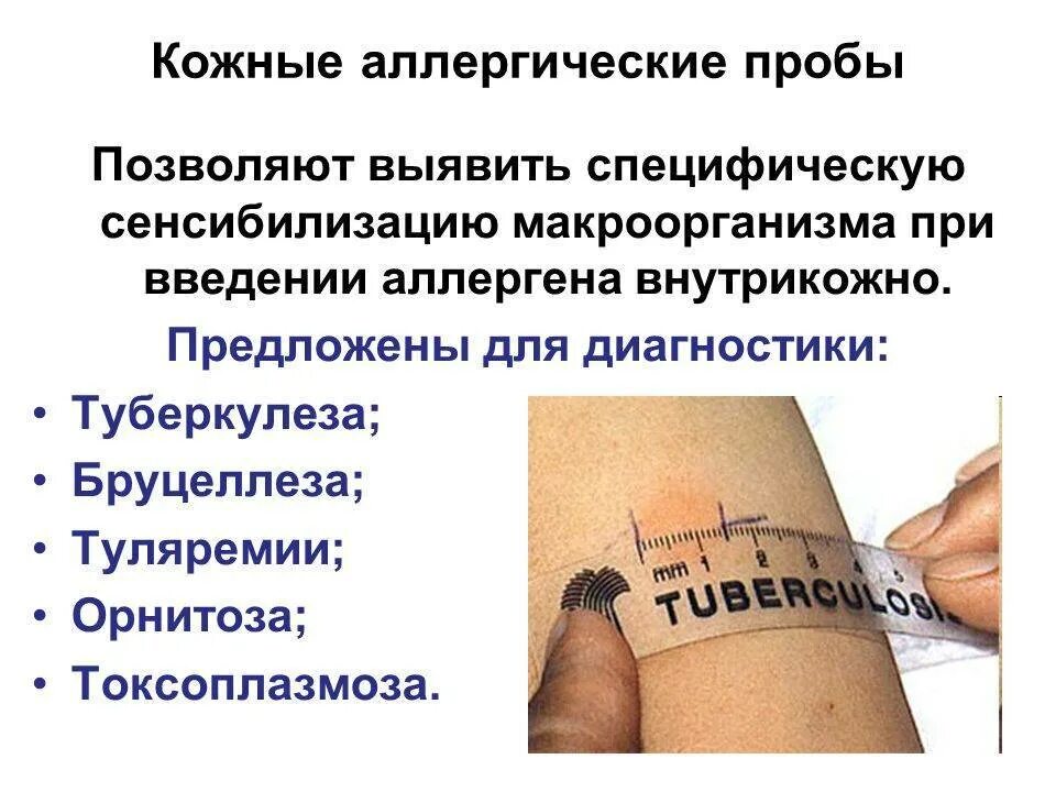 Постановка кожно аллергических проб это метод. Кожно-аллергические пробы иммунология. Кожно аллергическая проба туляремия. Кожные аллергические пробы.