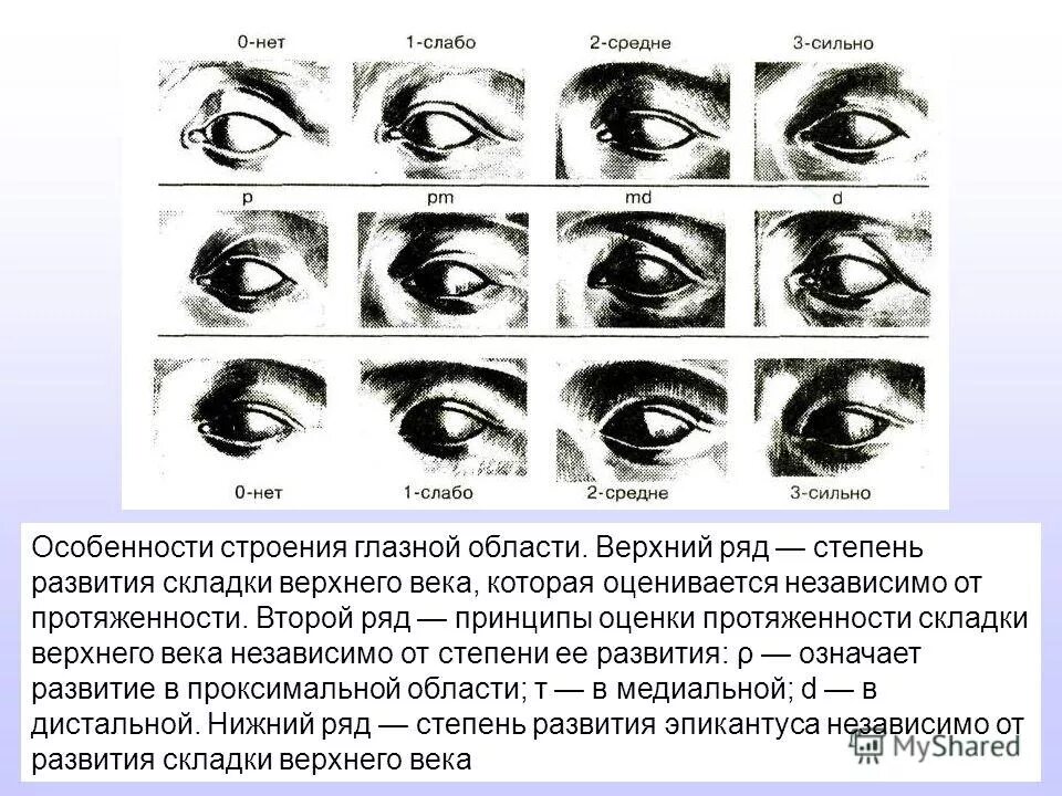 Виды век. Складка верхнего века антропология. Развитие складки верхнего века. Сильно развитая складка верхнего века. Степень развития складки верхнего века.