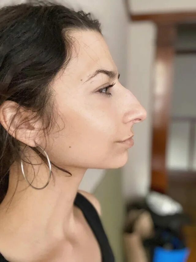 человек с большими ноздрями. широкий нос у девушек. красивый женский нос с горбинкой. длинный нос у мужчин. крупные ноздри.